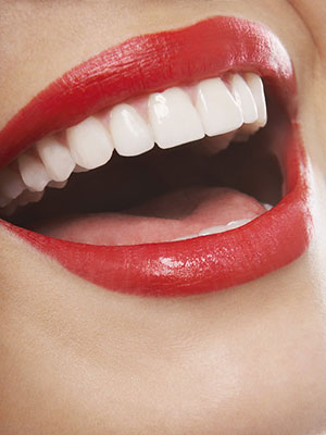 periodontal plastic surgery